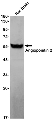 Recombinant Angiopoietin-2/ANG 2 Monoclonal Antibody - 1