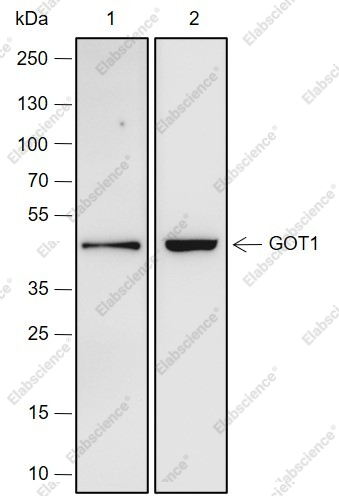 Recombinant GOT1 Monoclonal Antibody - 1