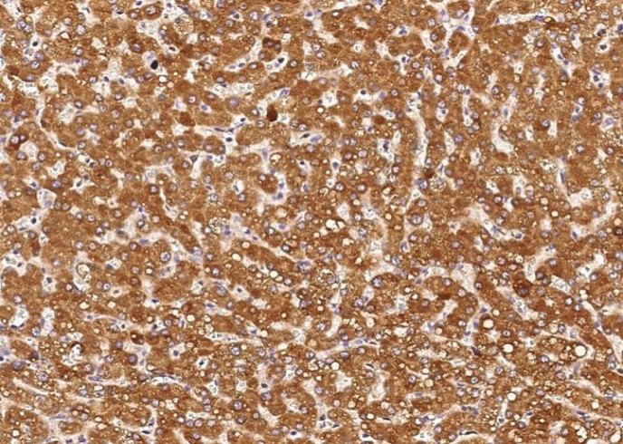 Recombinant ENTPD5 Monoclonal Antibody - small - 2