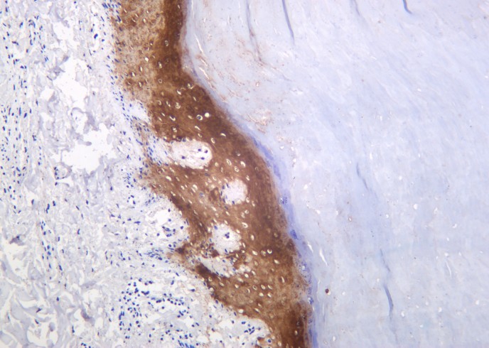 Recombinant Cytokeratin 10 Monoclonal Antibody - small - 2