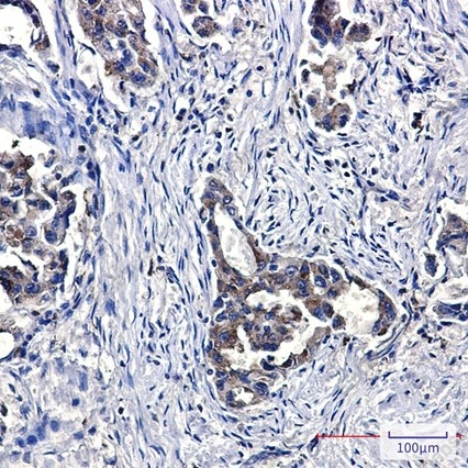 Recombinant NPC2 Monoclonal Antibody - 3