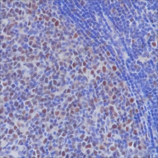 Recombinant MSH2 Monoclonal Antibody - 3
