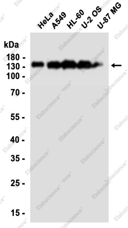Recombinant Ubiquitin Conjugation Factor E4 B Monoclonal Antibody - 2