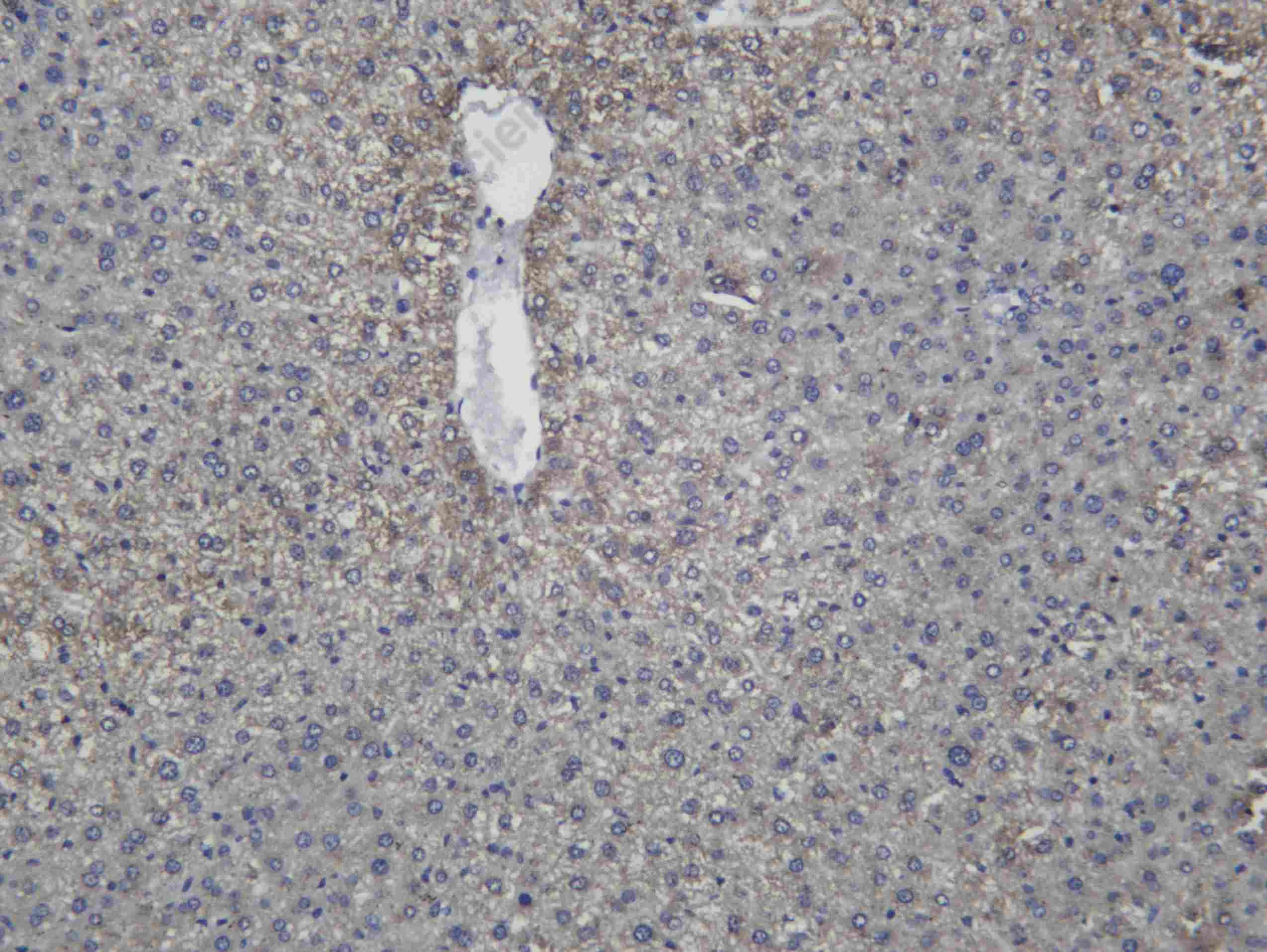Recombinant MCAD Monoclonal Antibody - 2