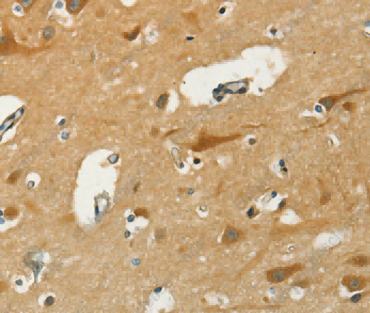 KLC1 Polyclonal Antibody - 3