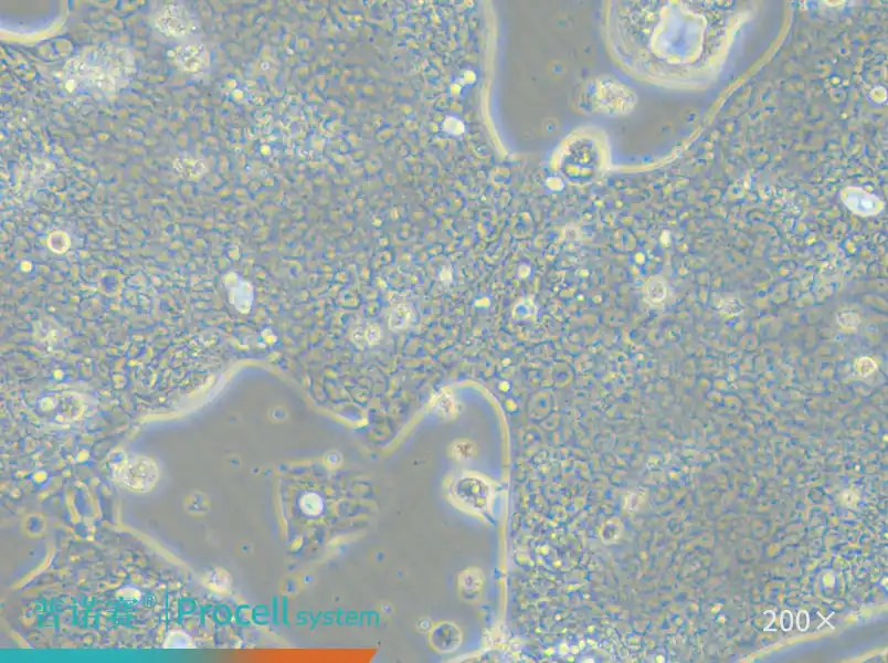 NCI-N87 [N87]（人胃癌细胞）-细胞系-武汉普诺赛生命科技有限公司