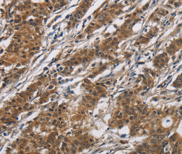 DHRS3 Polyclonal Antibody - 3