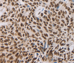 AKAP8 Polyclonal Antibody - 2