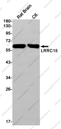 Recombinant LRRC15 Monoclonal Antibody - 1