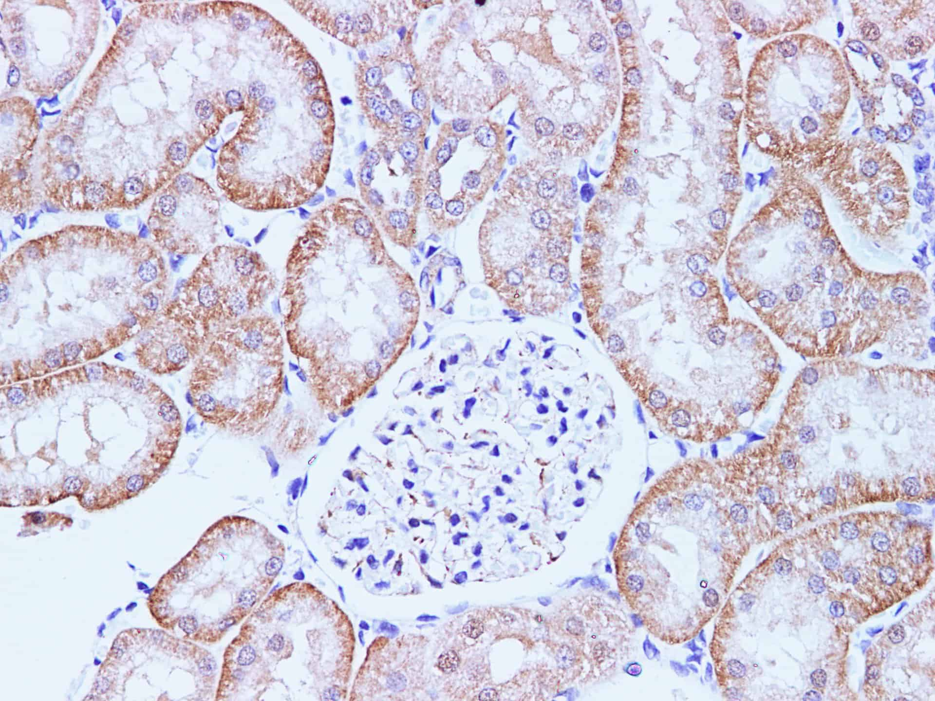 Immunohistochemistry of paraffin-embedded Rat kidney using CCL2 Polyclonal Antibody at dilution of 1:100