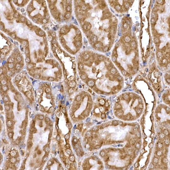 Immunohistochemistry of paraffin-embedded rat kidney using DYNC1LI2 Polyclonal Antibody at dilution of 1:20 (40x lens).Perform high pressure antigen retrieval with 10 mM citrate buffer pH 6.0 before commencing with IHC staining protocol.