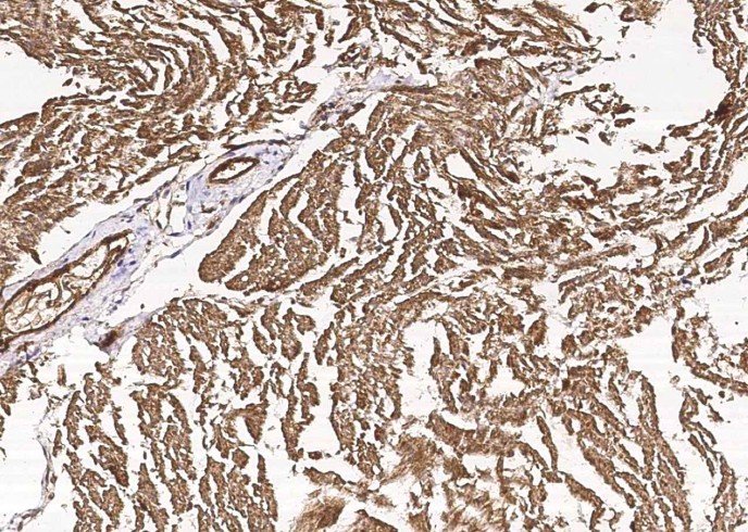 Recombinant CIB2 Monoclonal Antibody-searchlist-1