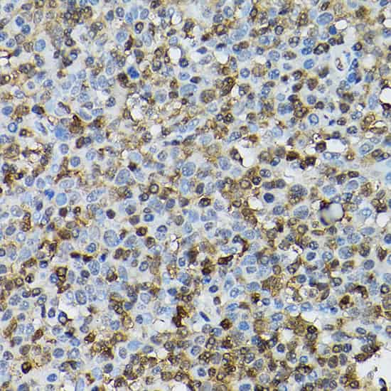 Immunohistochemistry of paraffin-embedded human tonsil using [KO Validated] STAT5B Polyclonal Antibody at dilution of 1:100 (40x lens).Perform high pressure antigen retrieval with 10 mM citrate buffer pH 6.0 before commencing with IHC staining protocol.