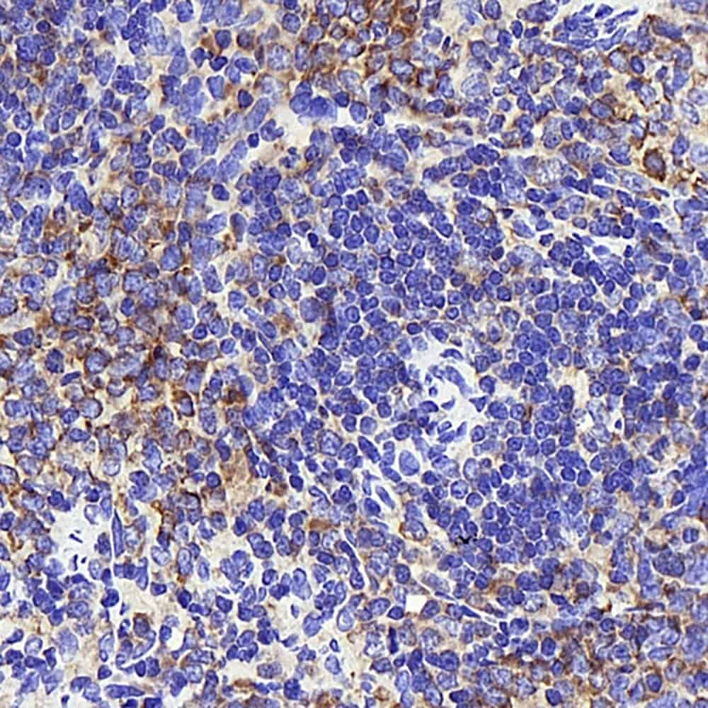 Immunohistochemistry analysis of paraffin-embedded rat thymus tissue   using INPP5D Polyclonal Antibody at dilution of 1:300.