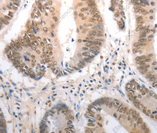 RAD50 Polyclonal Antibody - 2