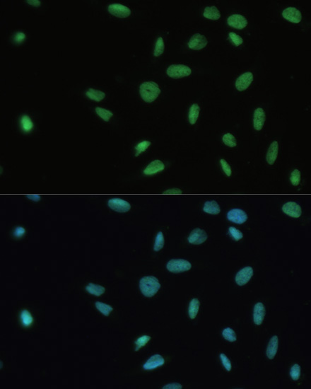 Immunofluorescence analysis of U-2 OS cells using SET Polyclonal Antibody at dilution of 1:100. Blue: DAPI for nuclear staining.