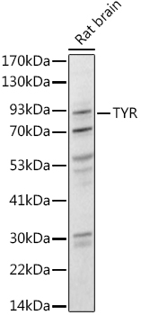 Western blot analysis of extracts of Rat brain using Tyrosinase Polyclonal Antibody at 1:1000 dilution.