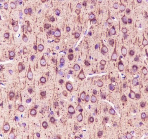 Recombinant beta II Tubulin Monoclonal Antibody - small - 4