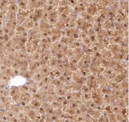 Recombinant FABP1 Monoclonal Antibody - small - 4