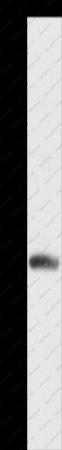 DCK Polyclonal Antibody - 1