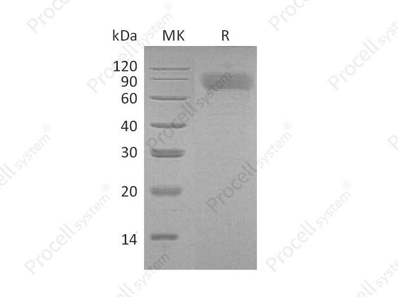 TPO/THPO (N-6His), Mouse, Recombinant