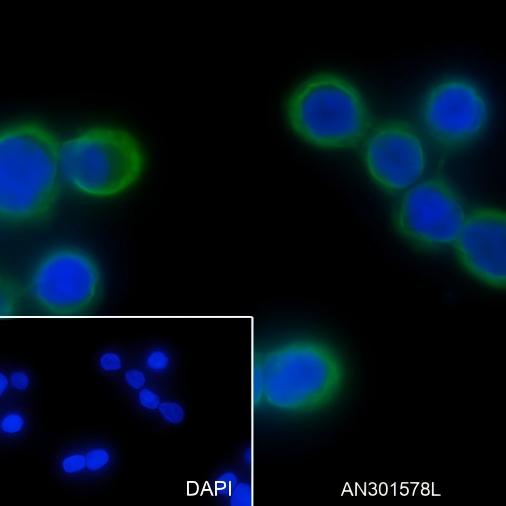 Recombinant Keratin 20 Monoclonal Antibody - small - 4