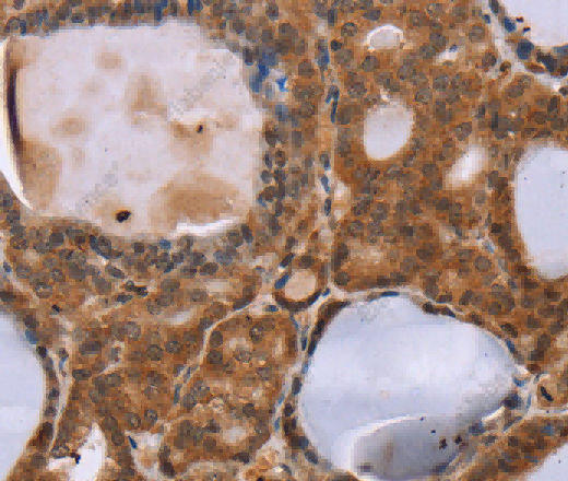 NDUFA2 Polyclonal Antibody - 2