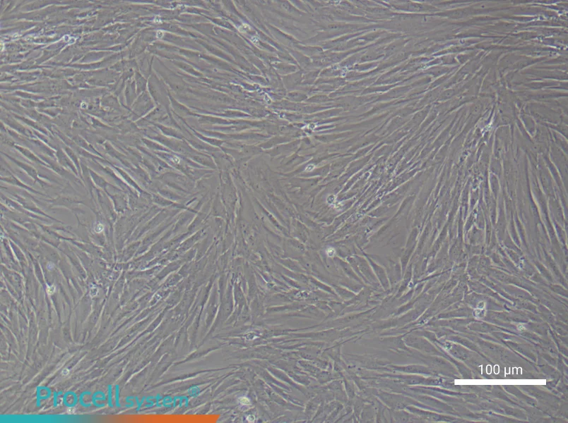 Human Pulmonary Artery Smooth Muscle Cell Complete Medium - 2