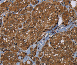 HSD17B4 Polyclonal Antibody - 3