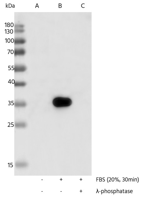 Recombinant Phospho-S6 Ribosomal Protein (Ser240, 244) Monoclonal Antibody - small - 4
