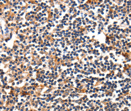 FADD Polyclonal Antibody - 3