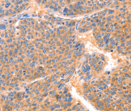 PRDX2 Polyclonal Antibody - 2