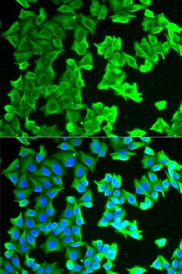 Immunofluorescence analysis of HeLa cells using RPLP0 Polyclonal Antibody Blue: DAPI for nuclear staining.