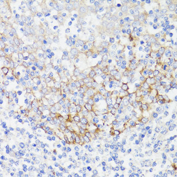 Immunohistochemistry of paraffin-embedded Human tonsil using EGFR Polyclonal Antibody at dilution of 1:150 (40x lens).