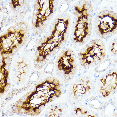 Immunohistochemistry of paraffin-embedded rat kidney using SLC3A1 Polyclonal Antibody at dilution of 1:200 (40x lens).Perform high pressure antigen retrieval with 10 mM citrate buffer pH 6.0 before commencing with IHC staining protocol.