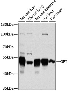 Western blot analysis of extracts of various cell lines using GPT Polyclonal Antibody at 1:1000 dilution.