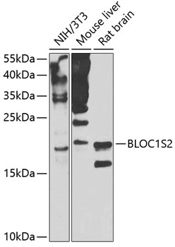 Western blot analysis of extracts of various cell lines using BLOC1S2 Polyclonal Antibody at 1:1000 dilution.