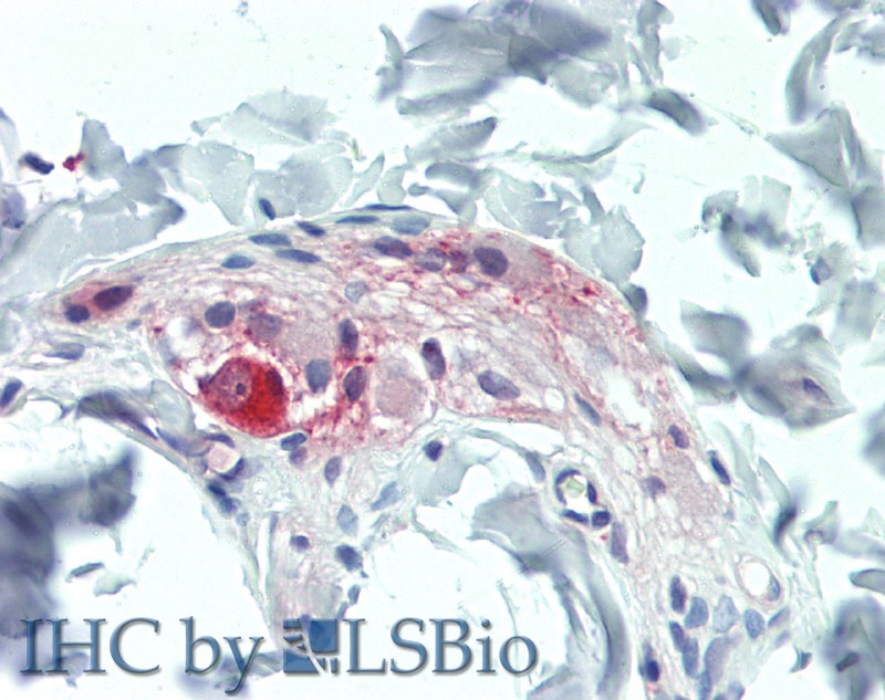 Immunohistochemistry of paraffin-embedded Colon, Submucosal Plexus tissue using TAC1 Polyclonal Antibody at dilution of 1:100(Elabscience Product Detected by Lifespan).