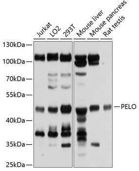 Western blot analysis of extracts of various cell lines using PELO Polyclonal Antibody at 1:1000 dilution.