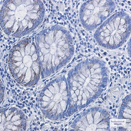 Recombinant HADHA Monoclonal Antibody - 2