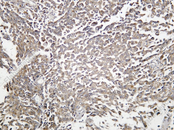 Recombinant Pan-TEF Monoclonal Antibody - 1