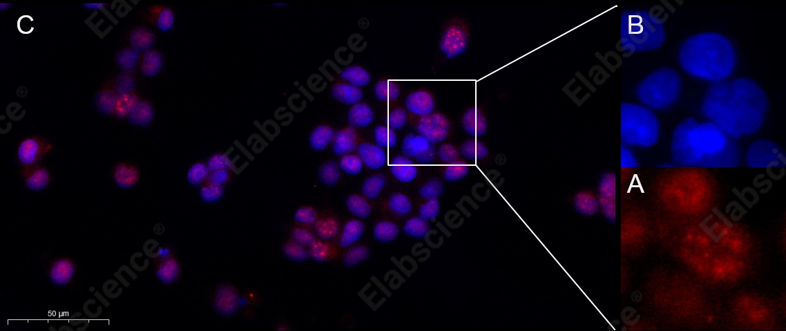 Recombinant Phospho-Akt (Thr308) Monoclonal Antibody - 5