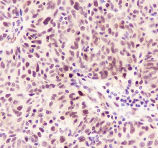 Recombinant FEN1 Monoclonal Antibody - 3