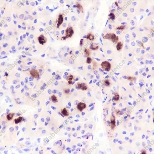 Recombinant Luteinizing Hormone beta Monoclonal Antibody - 2