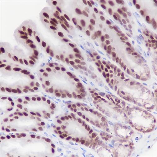 Recombinant Ku80 Monoclonal Antibody - small - 2