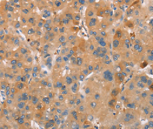 PLIN2 Polyclonal Antibody - 2