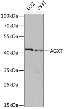 Western blot analysis of extracts of various cell lines using AGXT Polyclonal Antibody at dilution of 1:1000.