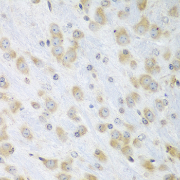 Immunohistochemistry of paraffin-embedded Mouse brain using PDIA3 Polyclonal Antibody at dilution of 1:100 (40x lens).