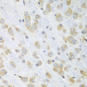 Immunohistochemistry of paraffin-embedded Mouse brain using PDIA3 Polyclonal Antibody at dilution of  1:100 (40x lens).