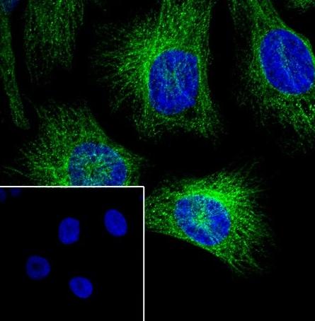 Recombinant beta Tubulin Monoclonal Antibody - small - 5